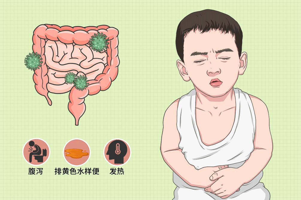 儿童急性肠炎吃什么药好