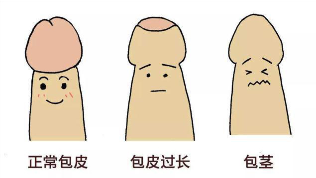 小儿包皮包茎该如何预防好呢?