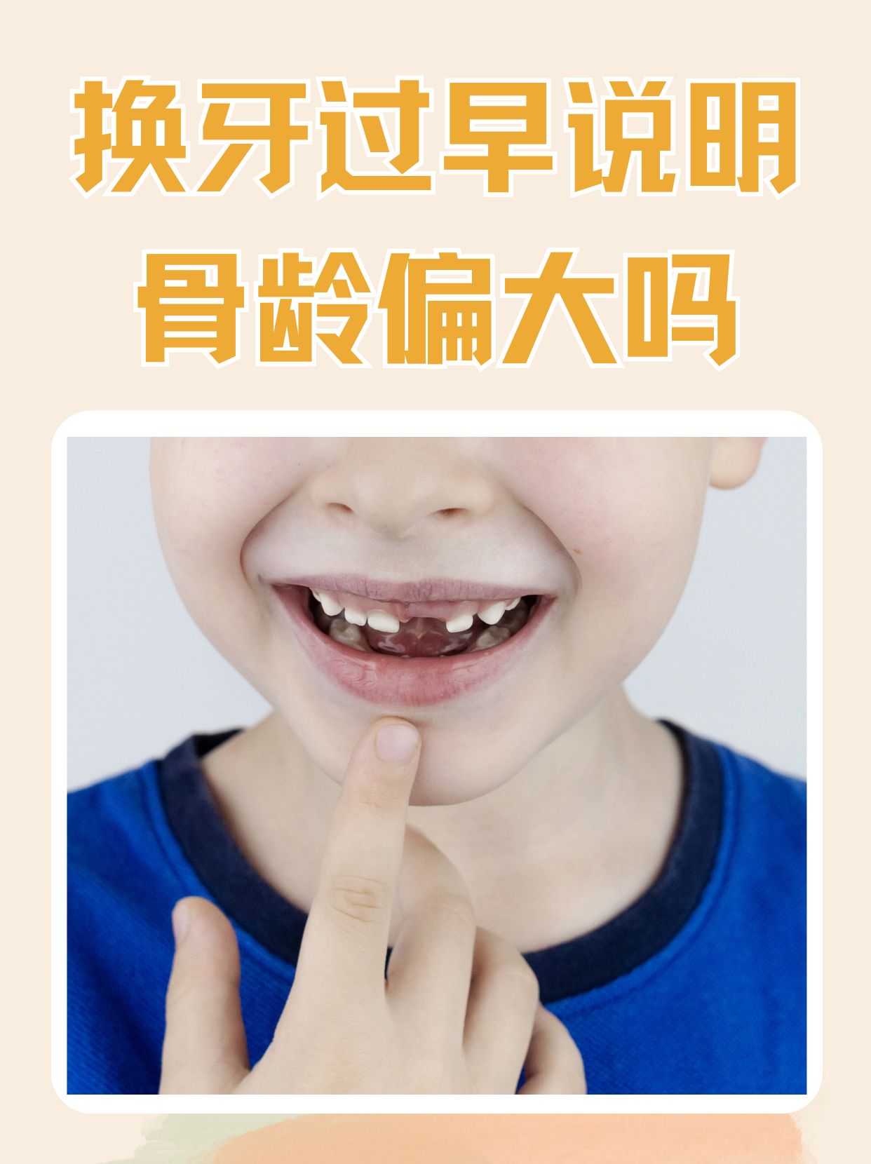 换牙过早与骨龄偏大：解开儿童成长密码，西安附一儿童医院为您护航